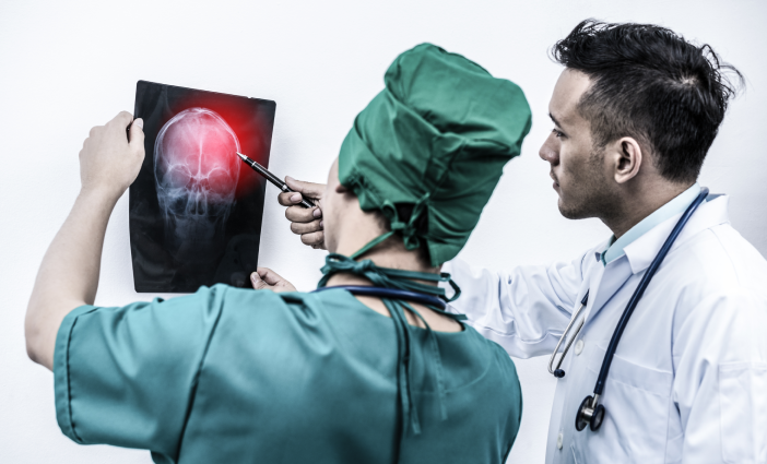 Medical illustration showing a traumatic brain injury and areas of the brain affected by head trauma.